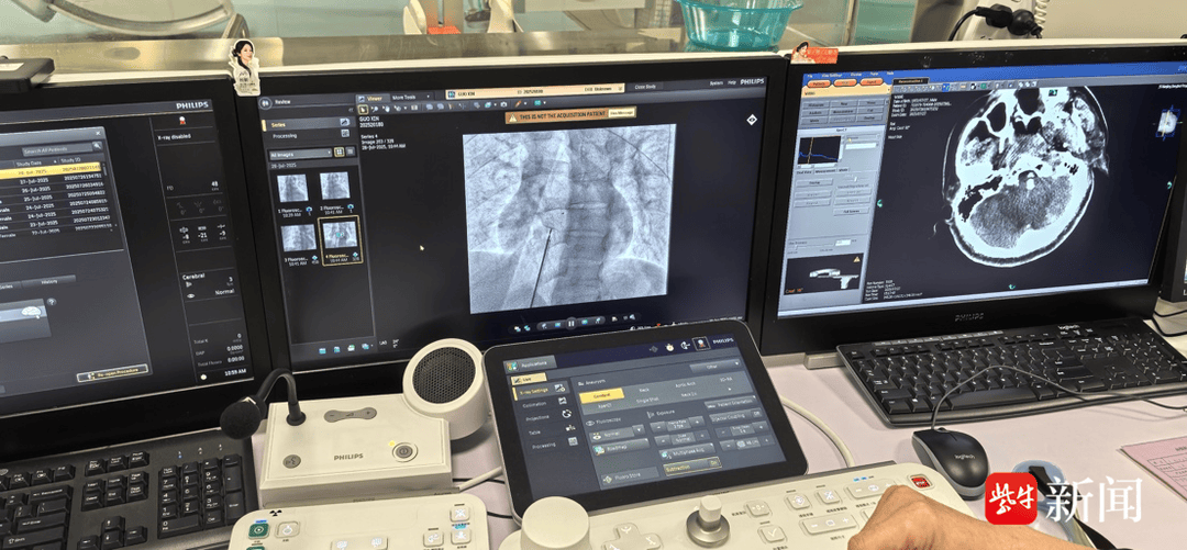 如何代理皇冠信用網_36岁青年男性突发脑梗死如何代理皇冠信用網，病因竟是心脏上有个“洞”！