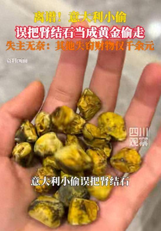 皇冠信用网代理注册_小偷误将肾结石当黄金偷走皇冠信用网代理注册,失主:两块肾结石用盒子装着,小偷以为那是值钱的黄金